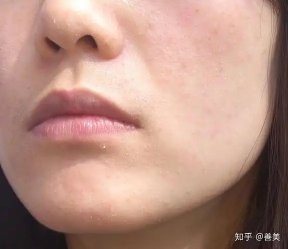 在选择护肤品时,一定要对自身皮肤的特点有足够的了解,今天就和大家