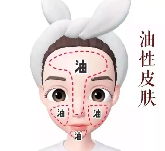 油皮特征:t区和两颊都很爱出油★油性皮肤:注意清洁重要的事情说三遍!