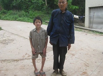 儿童佝偻病症状图片 (23)_有来医生