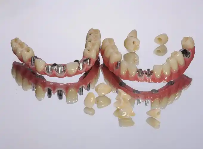 cad/cam纯钛种植桥