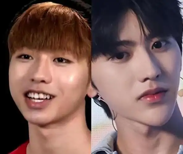 蔡徐坤被曝整容前东家晒整容费用15亿韩元整了3个部位