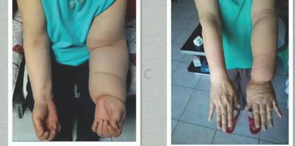 淋腿橄侔┗蚺枨话┲⒘馨颓迳ㄊ鹾蠡颊叱：喜⒘馨退