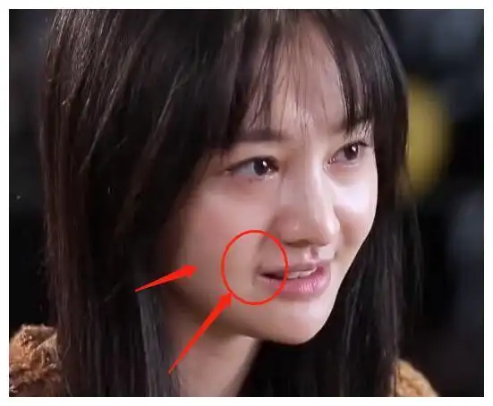 郑爽这是又"动刀"了?全素颜上节目怼脸拍,嘴角疤痕过于明显了