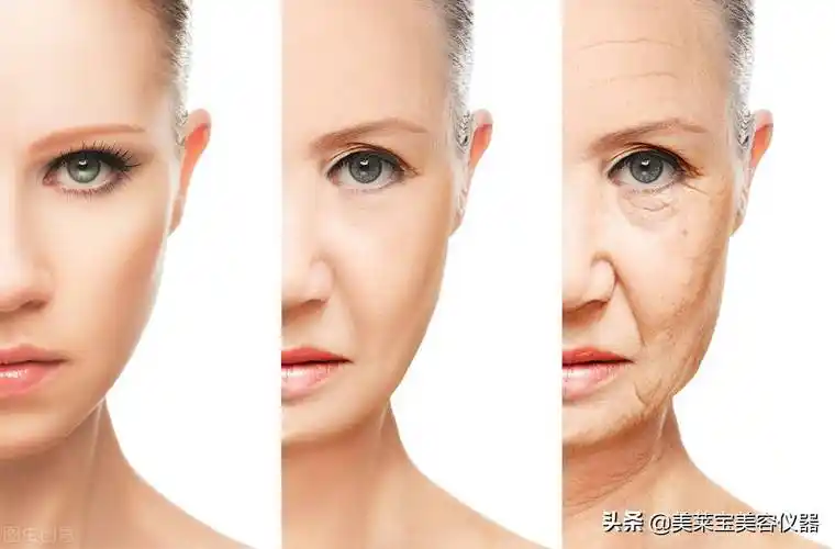 改善皮肤松弛皮肤松弛怎样可以让皮肤紧致呢