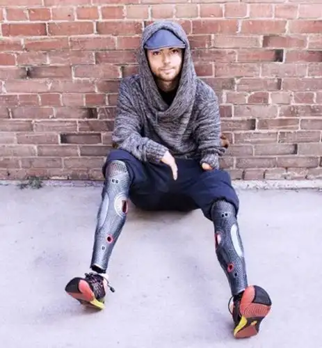 你想定制专属自己的个性假肢吗?