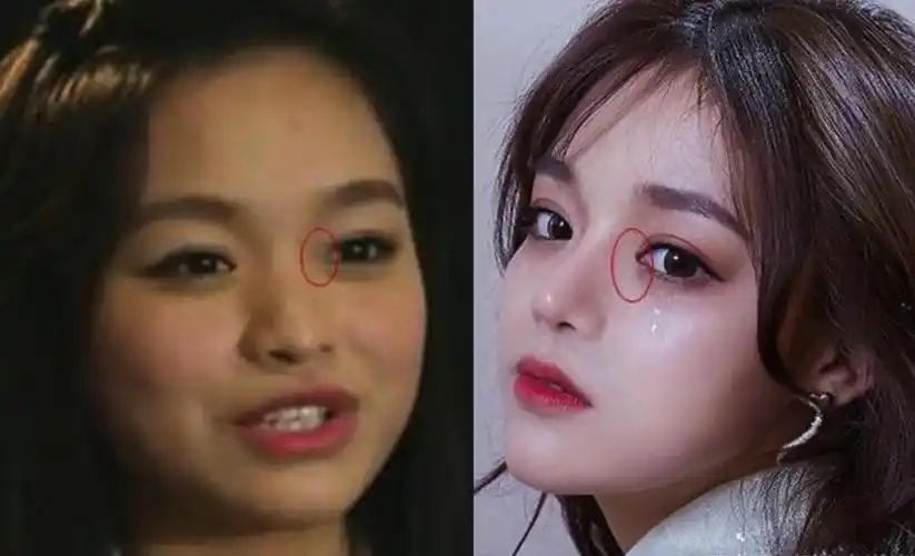 黄霄云长相变化有点大对比图黄霄云为什么叫面包