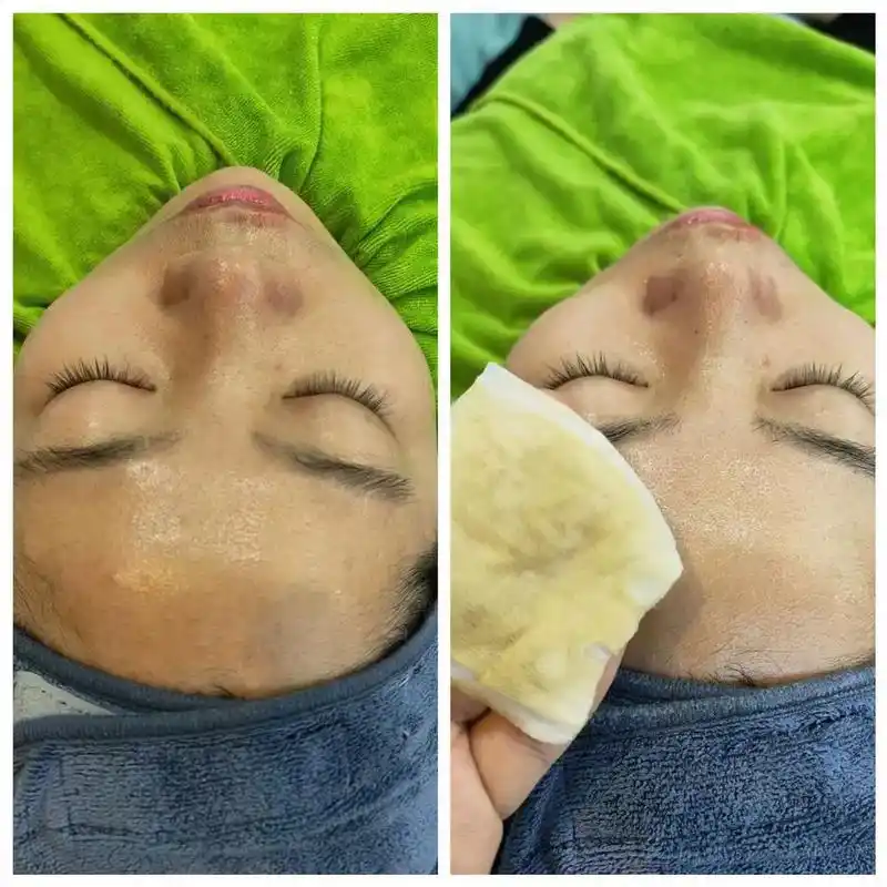 深层毛孔清洁 #好皮肤都是养出来的 好肌肤首先第一步注意清 - 抖音