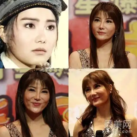 女星整容失败惨状巩新亮angelababy躺枪组图