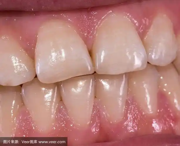 健康的人类牙齿-门牙,正面近距离观察