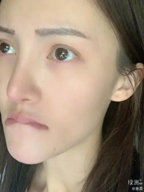 金晨绿洲晒假眉毛贴买家秀 怼脸拍皮肤细腻零毛孔