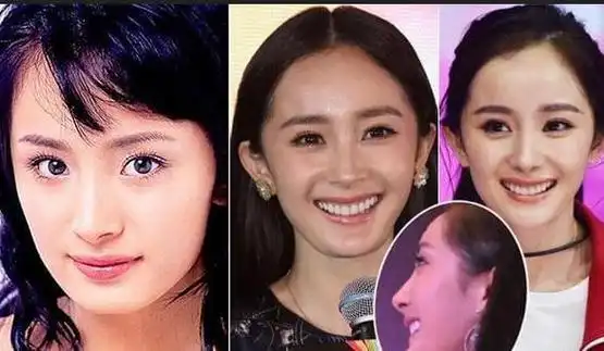 杨幂下巴忽尖忽短 今昔对比照颜值飙升|脸型|整容|锥子脸_网易订阅
