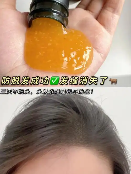 防脱去屑控油洗发水yyds秃头女孩必备