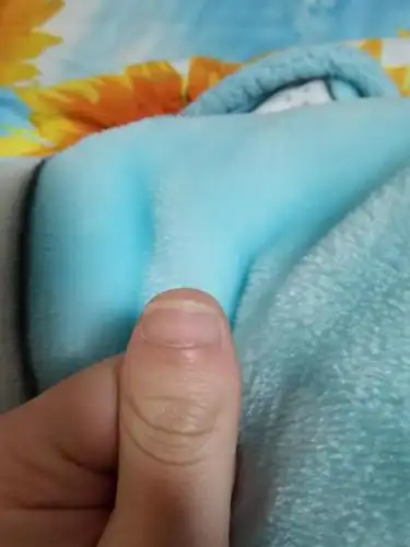 在楼主还是个baby的时候指甲就比别的刚出生的小婴儿短,现在我的指甲