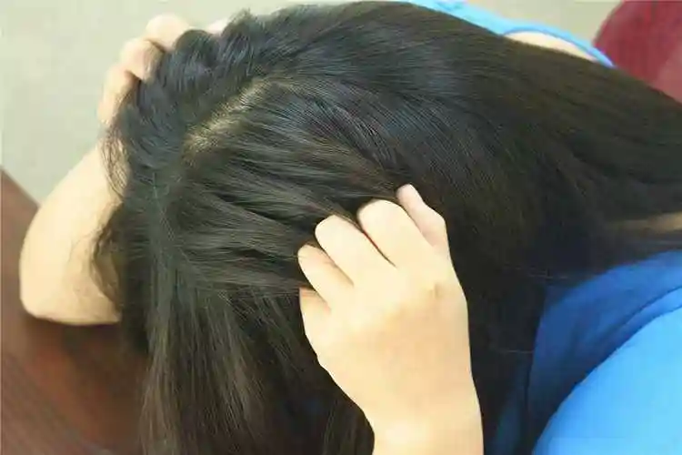 头皮痒怎么办头皮特别痒还有疙瘩