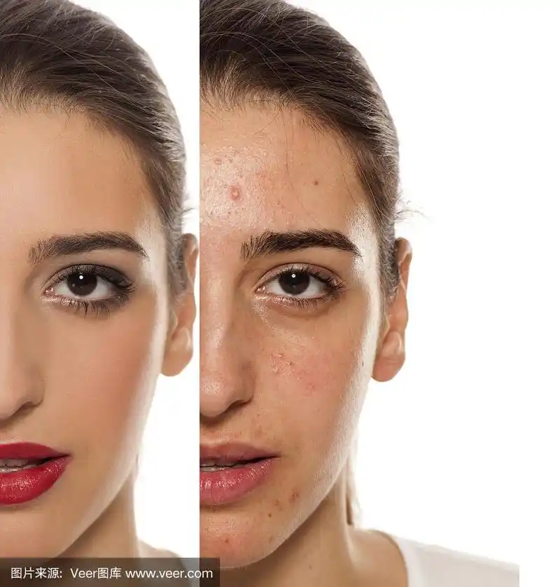 年轻女性脸上皮肤问题的化妆前后比较