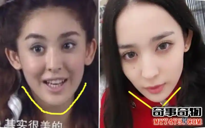 古力娜扎整容前后照片对比 到底是真的整容了还是被网友黑的呢