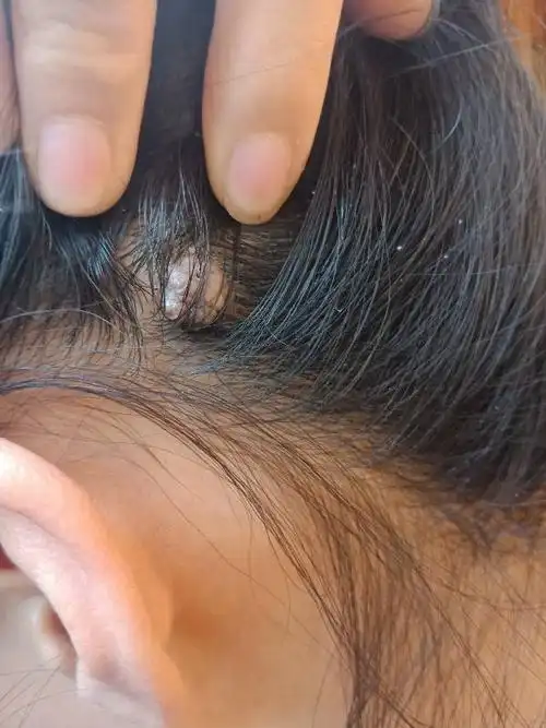 头上长的这个是猴子吗