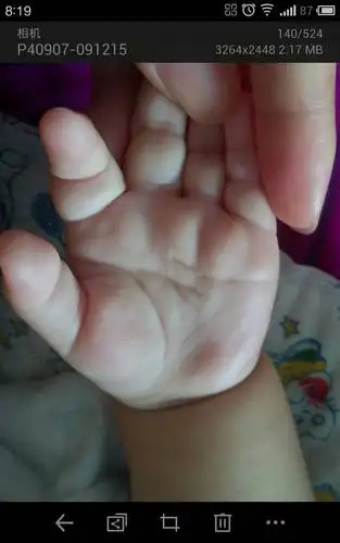 看手相 追问 额(⊙o⊙)… 回答 看纹路粗而清晰说明宝宝身体健康成长