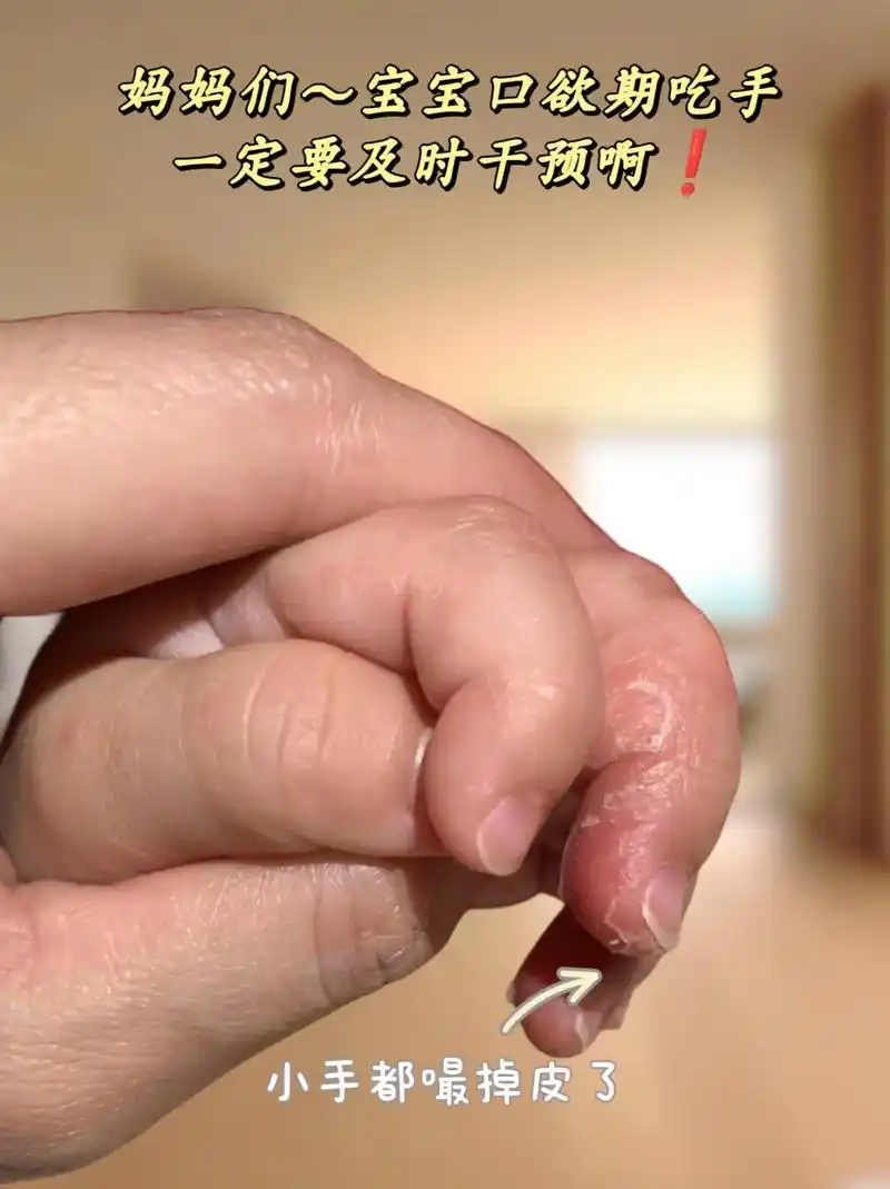 宝宝2-3个月开始进入#口欲期,经常流口水,吃手频繁,很容易 - 抖音