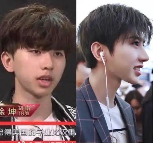 最近很火的蔡徐坤小哥哥,矫正后,有着完美的侧颜杀.