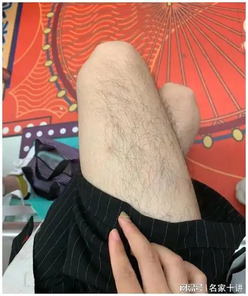 "|睫毛|胡子|腿毛_网易订阅