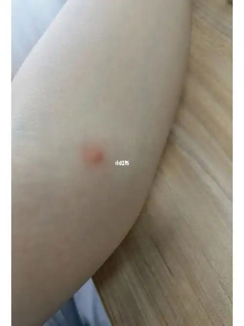 可以帮忙看一下是跳蚤咬的吗010101