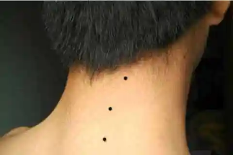 脖子有痣的人命运好不好