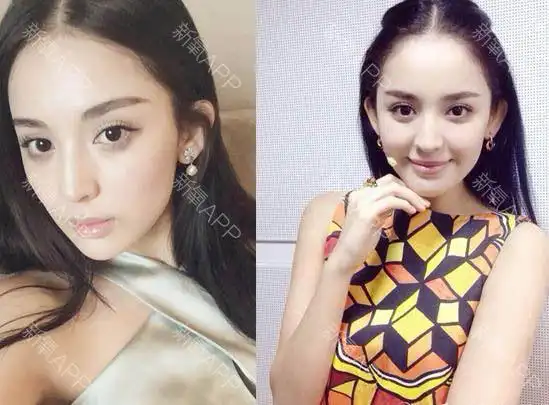 要说哪个明星最常上热搜,郑爽说第二,就没人敢说第一_圈子-新氧美容