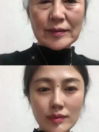 变老的样子 #在变老的路上善待自己 #还有多少个十年能记起青春的