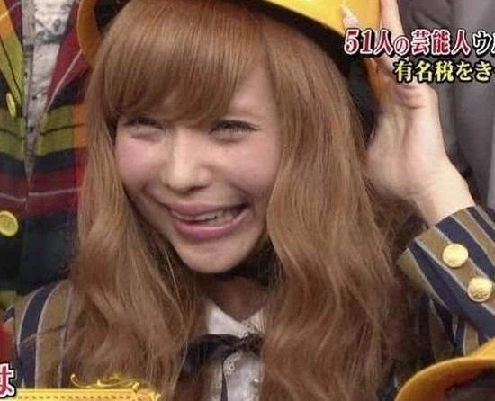 日本女星笑容扭曲不自然 被疑整容后遗症