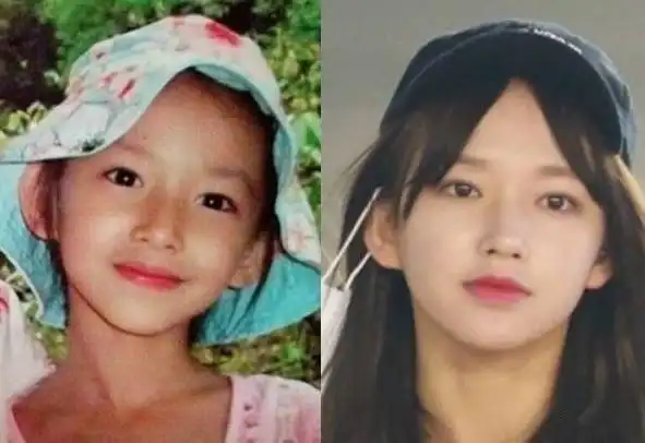 移严重的还有程潇,不过她算是天生的大脑门,博主翻到了她小时候的照片