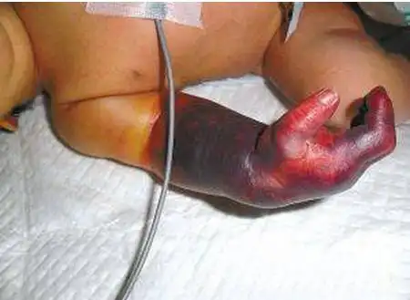 奶奶觉得宝宝好动,衣服做的有点大,而且家里的温度不高,害怕袖子,裤管