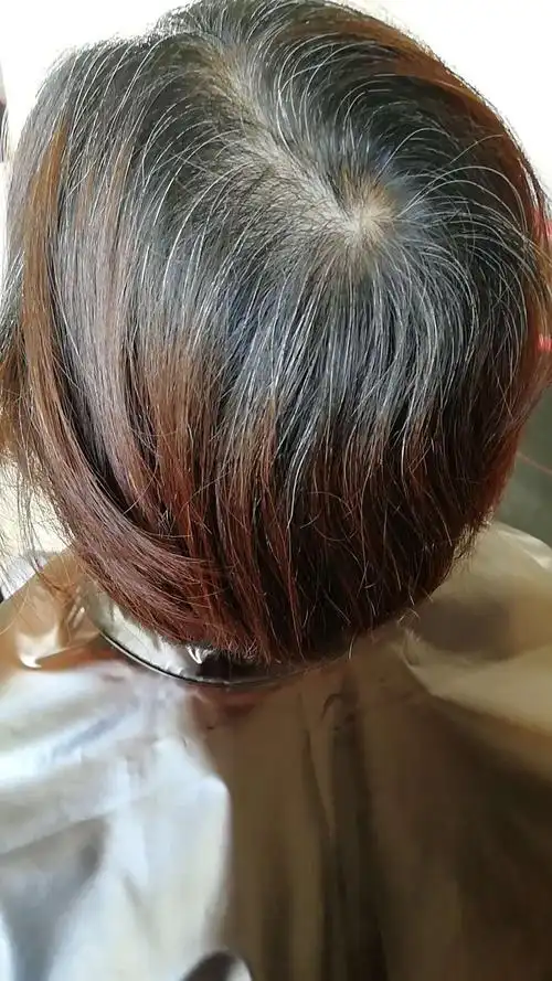 女性白头发日渐增多,别以为自己老了,可能是缺乏这3种营养_小猪生活