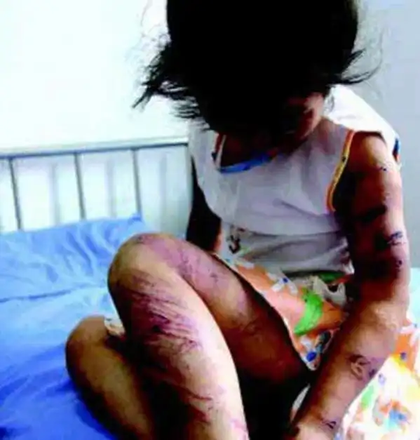 恶母燕志云虐死6岁女儿,被判入狱7年,出狱后掘开女儿坟墓泄愤