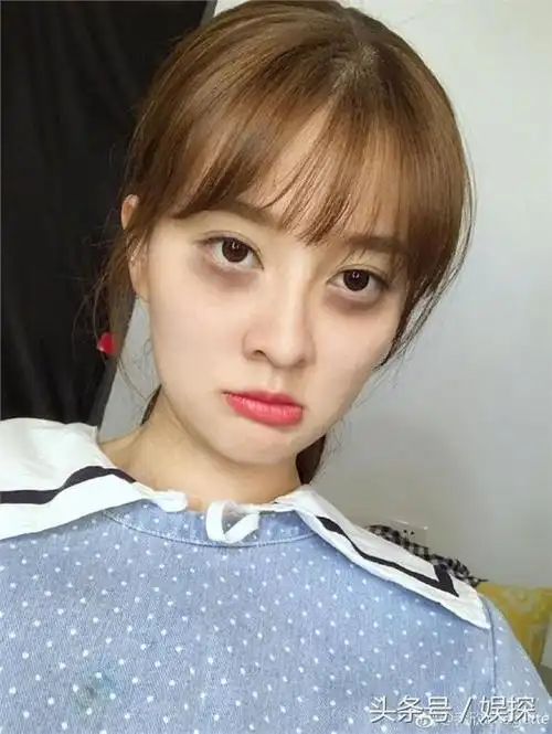 黑眼圈是为了自黑p上去的吧.