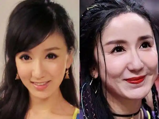 过度整容的几个明星,脸部僵硬十分怪异,因整容过度致无戏可拍_角色
