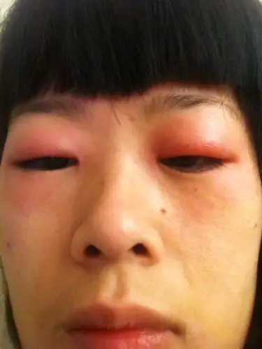 我是一个干夜场的人员,每天都得到凌晨3点才能睡