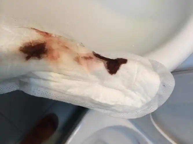 月经第五天:卫生巾上面是咖啡色的咋回事:不多