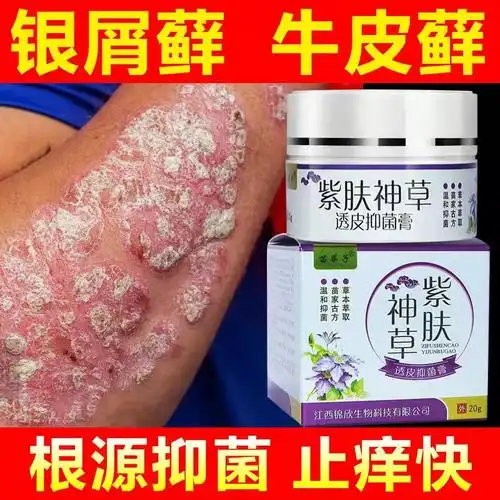 止痒膏 瘙痒特效 皮肤_牛皮癣专用药膏专治湿疹皮肤瘙痒外用银屑病