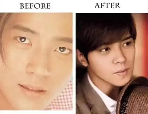 细数割过双眼皮的明星除了小猪最不可思议的是星爷也割过