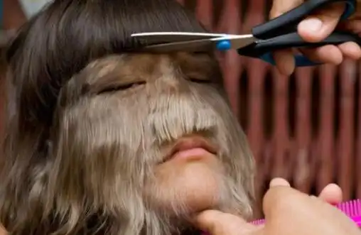 辽宁男子吃蛇后变"蛇人",身上长出鳞片,还会蜕皮