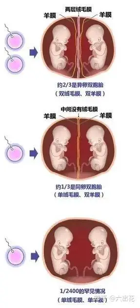 孕晚期双胞胎一般都是什么时候会发动? - 知乎