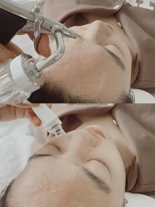 小气泡清洁大气泡清洁皮肤管理