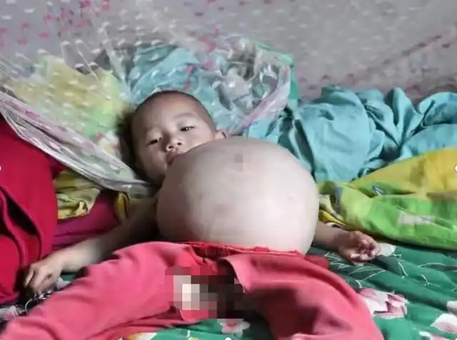 如果贸然进行手术,很可能对甜甜有生命危险.