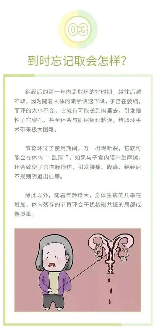 节育环都长到肉里了,怎么办?_手机搜狐网