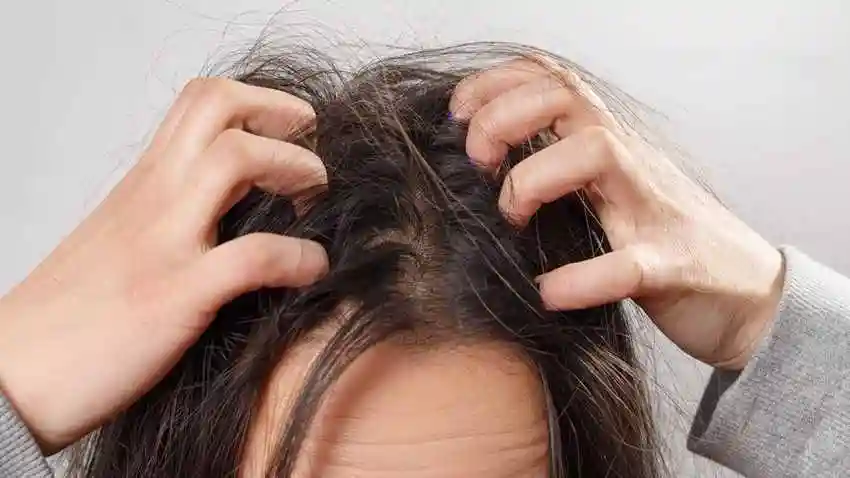 医生警告头皮痒不要抓!4种头皮皮肤病会传染吗?