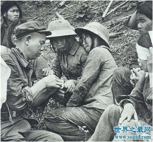 【图】海豹人是什么意思 澳洲曾有某男性天生为海豹人