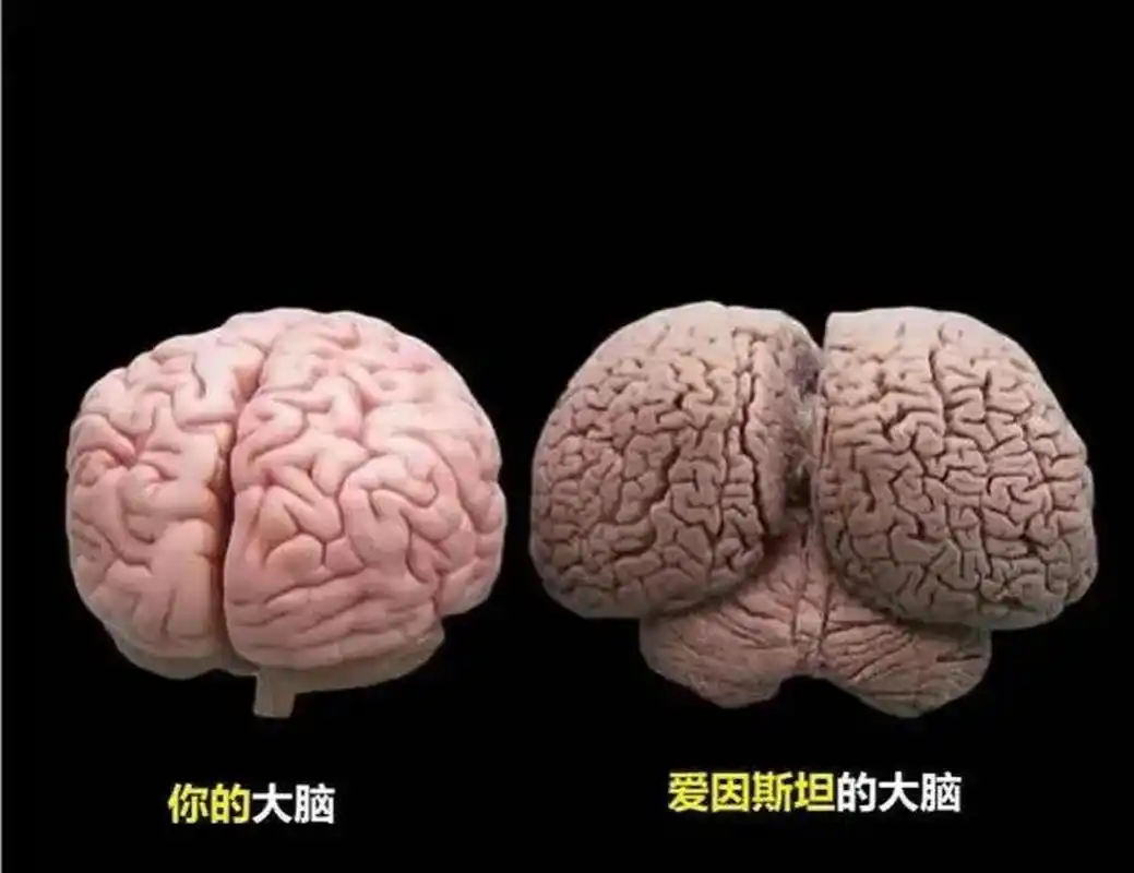 你的大脑和爱因斯坦的大脑有多大区别