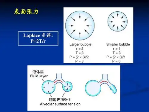 表面张力 laplace 定律: p=2t/r