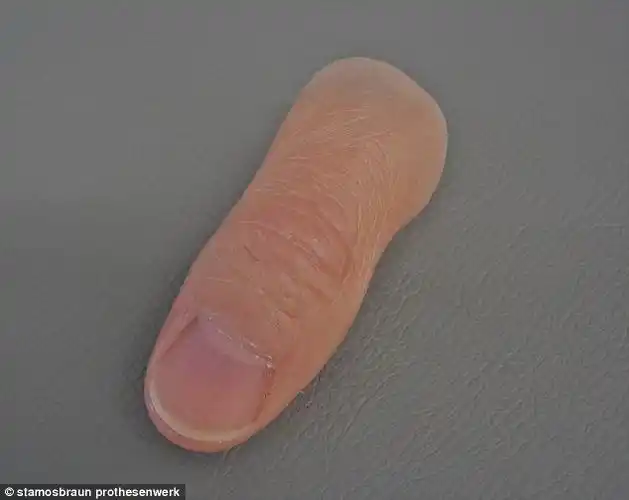 组图德国推出超级仿真的假肢您看出来了吗